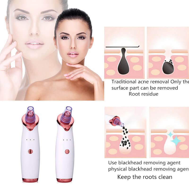 Blackhead Remover Instrument Black Dot Remover Acne Vacuum Suction Face Clean Black Head Pore Cleaning Beauty Skin Care Tool - ONESOOP